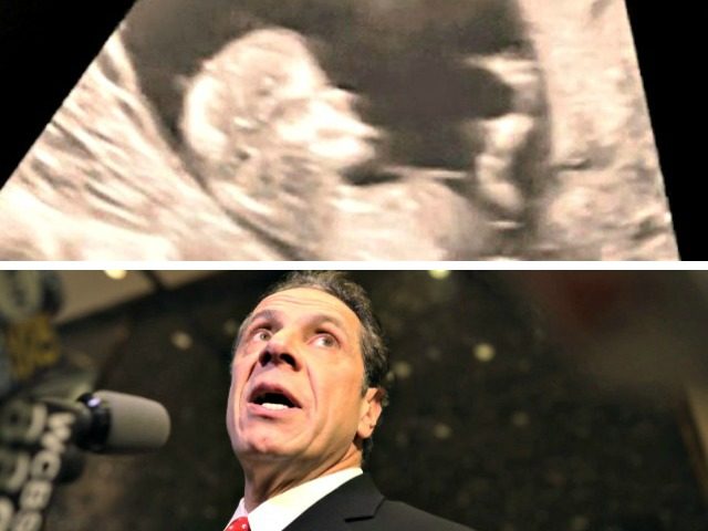 Ultrasound, Cuomo Looking Up jpg